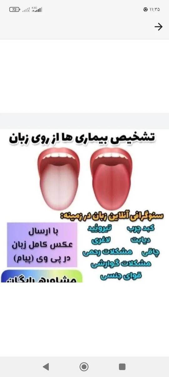 طب سنتی و درمان بیماریها ازطریق عکس زبان